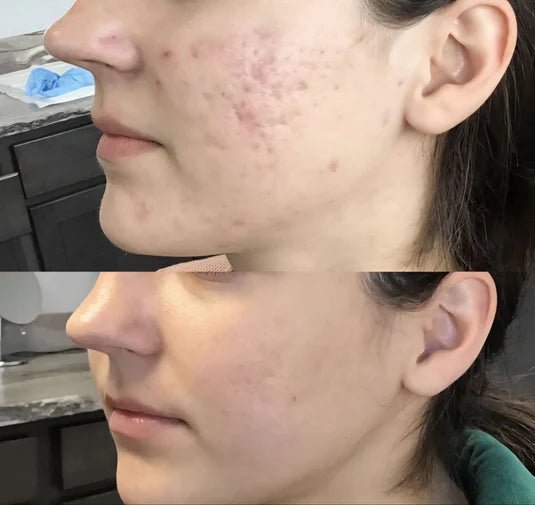 Dr. Melaxin Rice Peel Glow Serum - TheCalmHaven